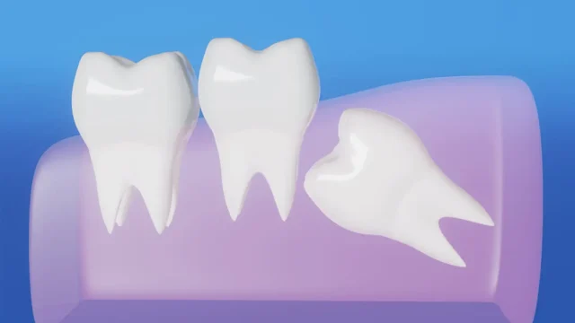 Dental Care